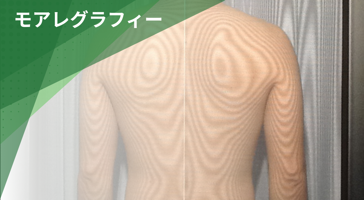 モアレグラフィーによる背骨や姿勢の歪みを確認する検査の様子